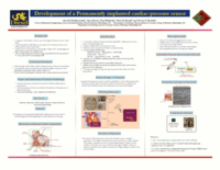 Development of a permanently implanted cardiac-pressure sensor